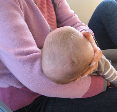 Torticolis, Tête Plate : Que Faire ? Santé'o - Kiné, Ostéo, Psy À Grenoble